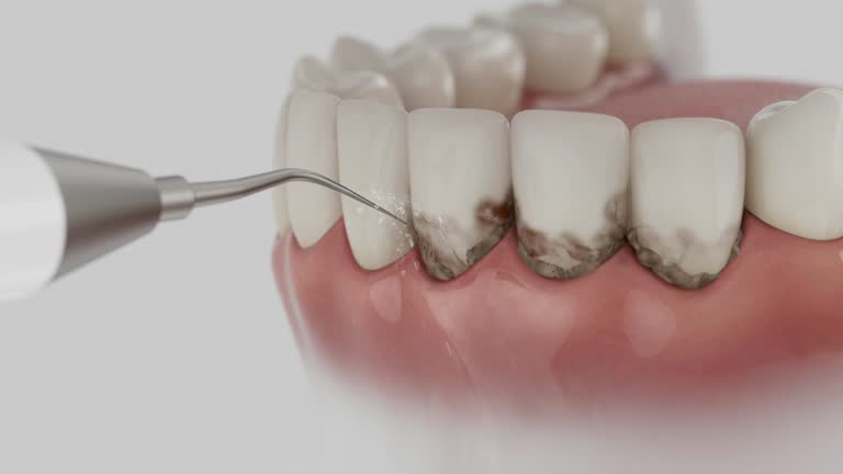 Trusted Emergency Dentist service in Tuscumbia, AL - Dentist Open Now